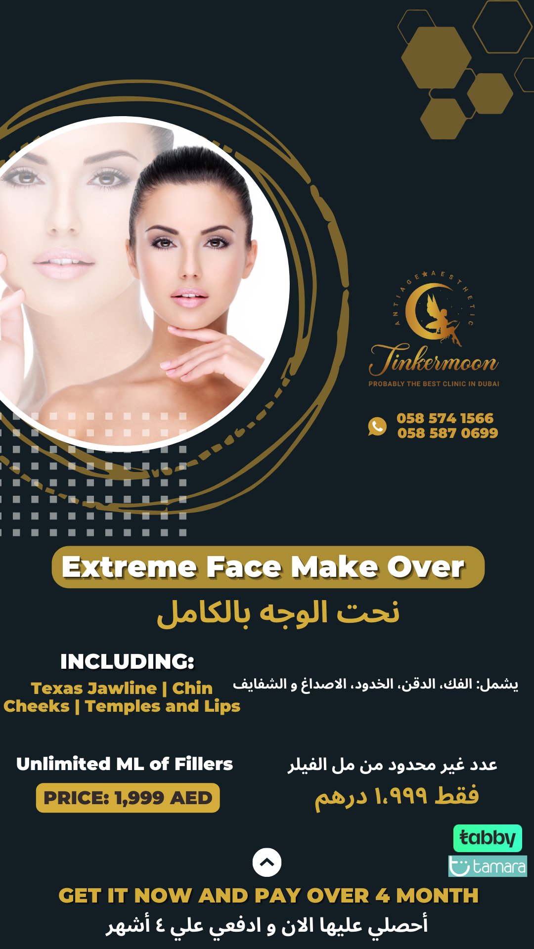Extreme Face Make Over: безлимит миллилитров филлеров — 1999 AED